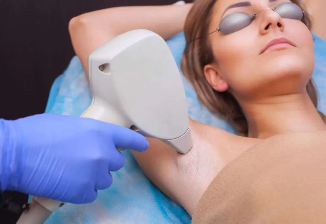Laser hair removal treatment in progress Alex James clinic Lancashire