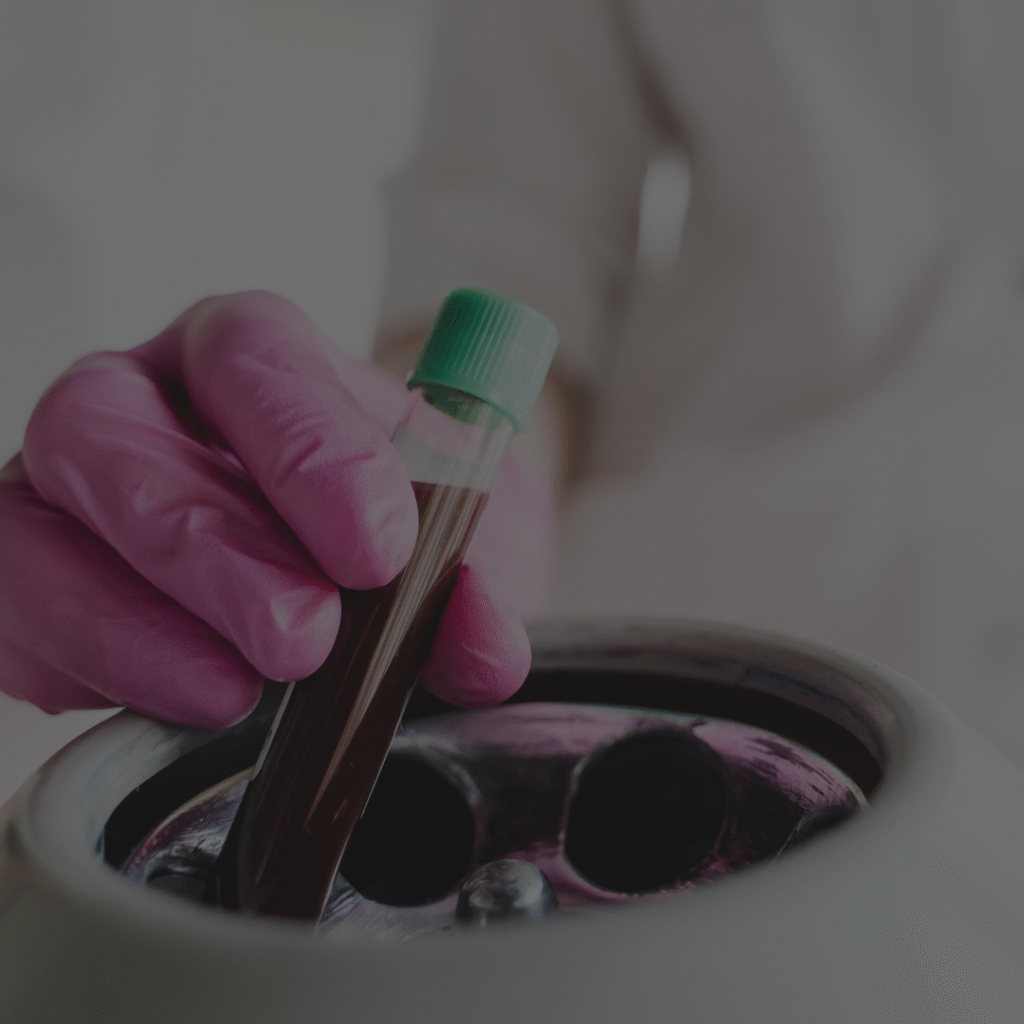 Advanced PRP treatment equipment Alex James Manchester clinic specialist tools