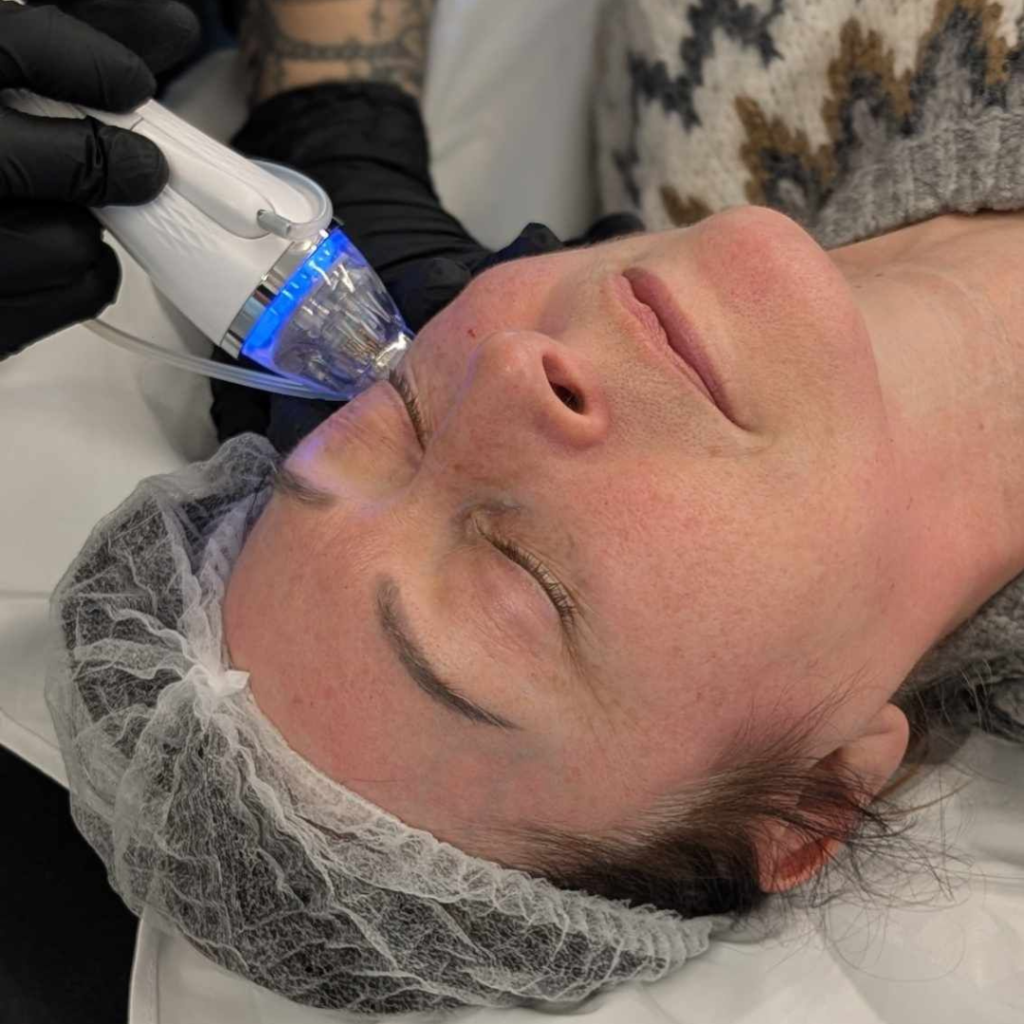 rf microneedling training course students learning techniques Alex James academy Manchester