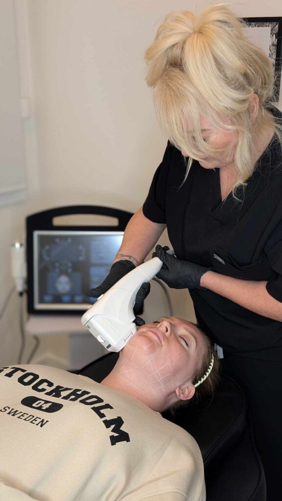 hifu training course students learning techniques Alex James academy Manchester