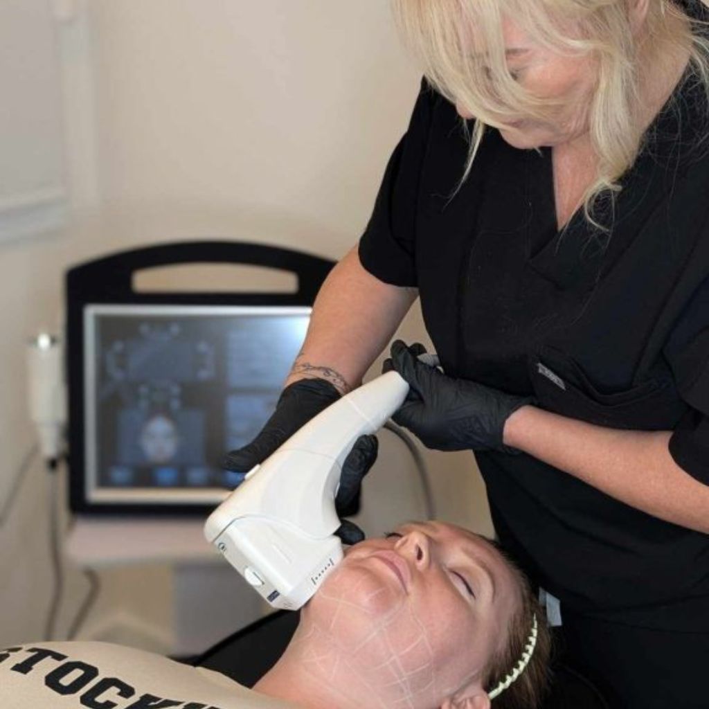 hifu training course students learning techniques Alex James academy Manchester