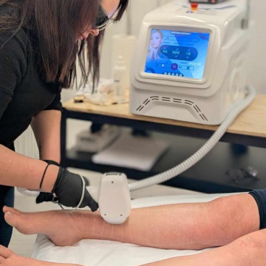 dual laser removal training course students learning techniques Alex James academy Manchester