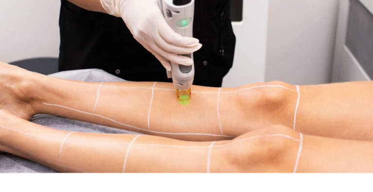 dual laser removal training course students learning techniques Alex James academy Manchester