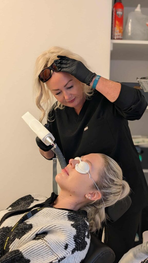 eyebrow tattoo removal