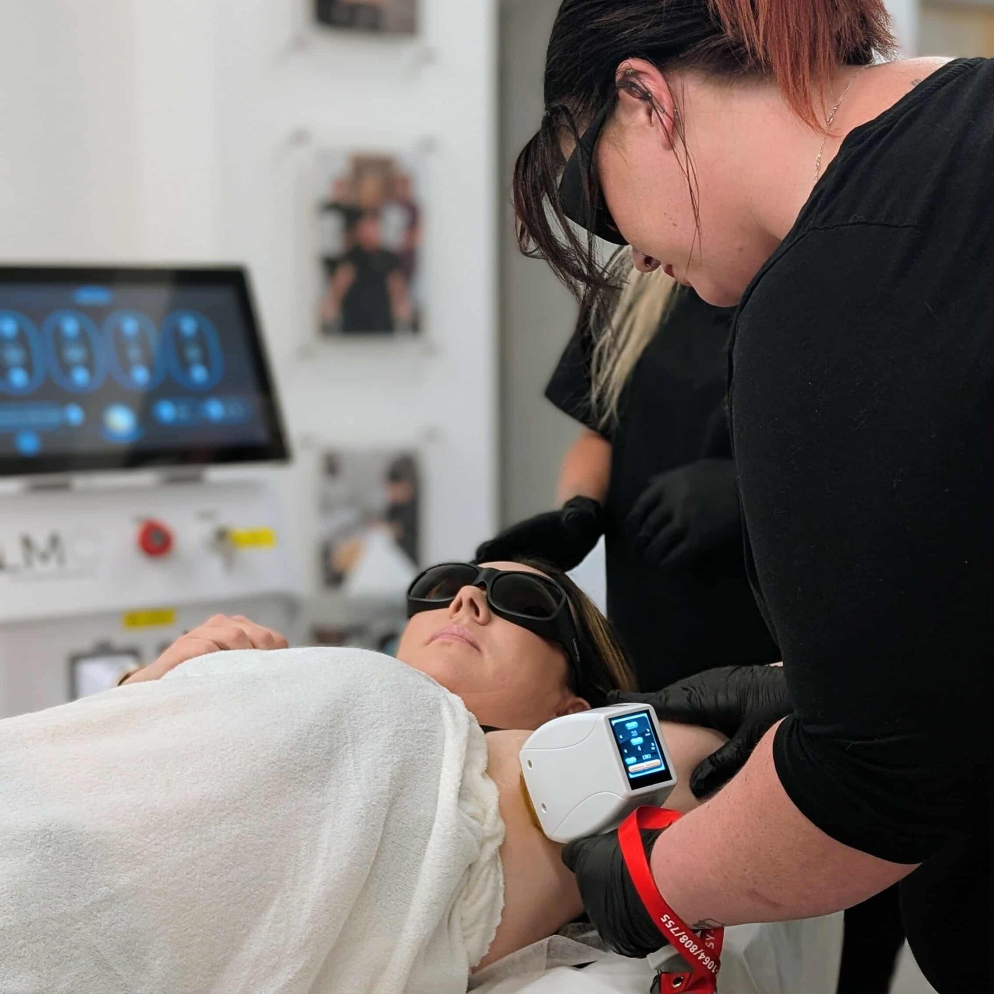 Laser hair removal process at Alex James Clinic