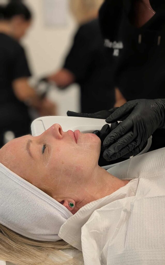 hifu treatment A;ex James Clinic in Manchester