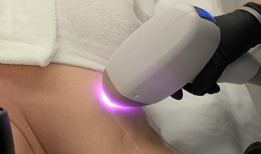 laser hair removal laser clinic north west