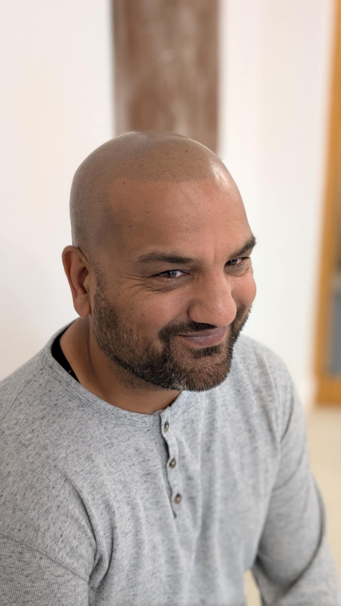 is scalp micropigmentation halal