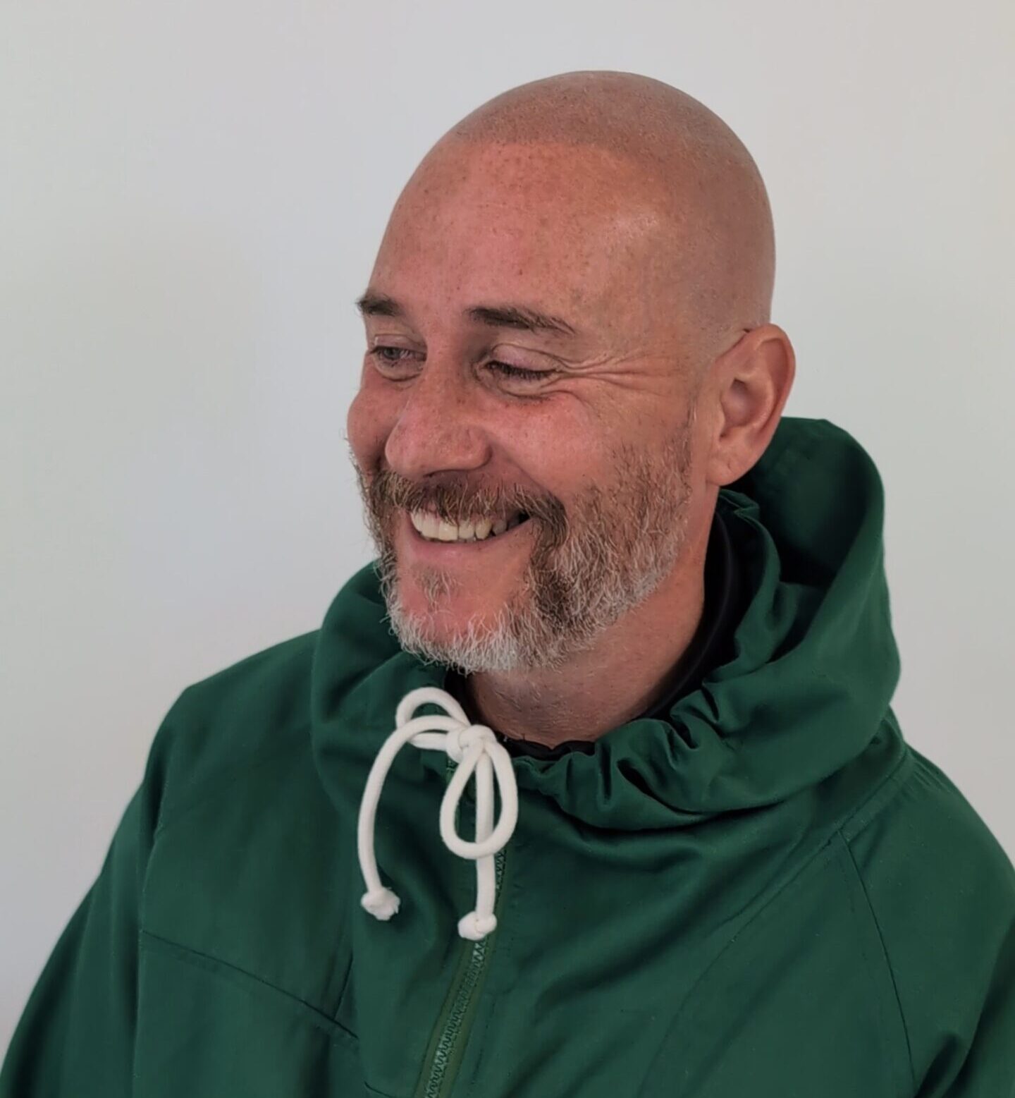 SMP treatment results at Alex James Clinic Manchester