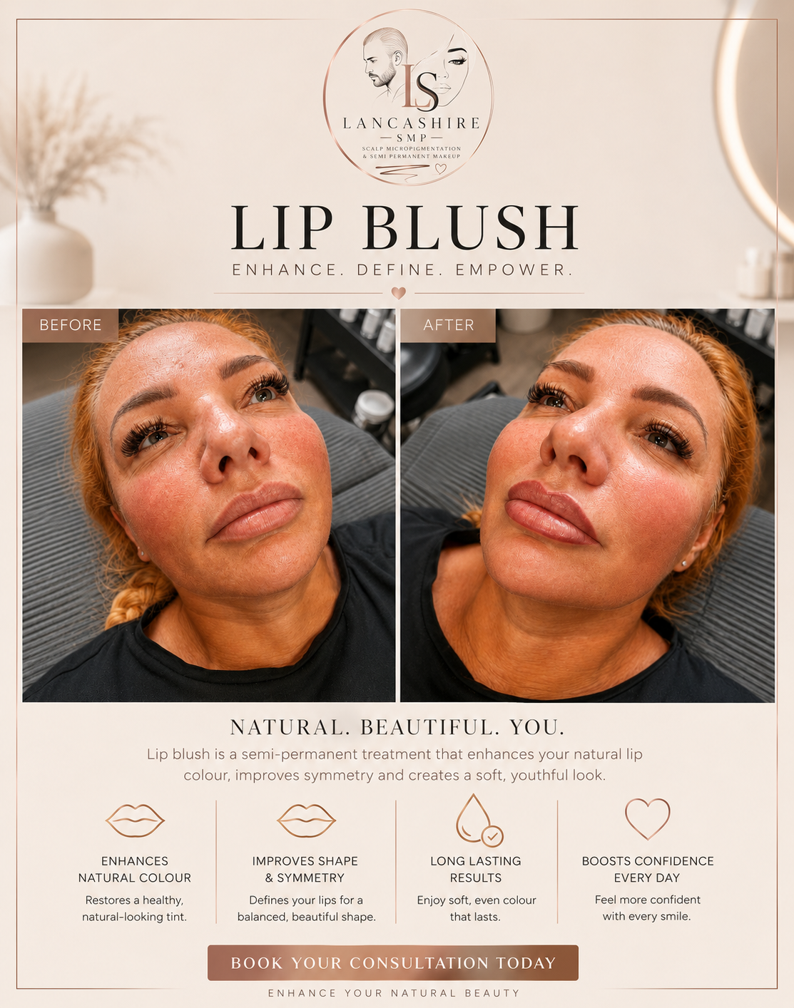 Lip blush treatment in progress at Alex James Clinic